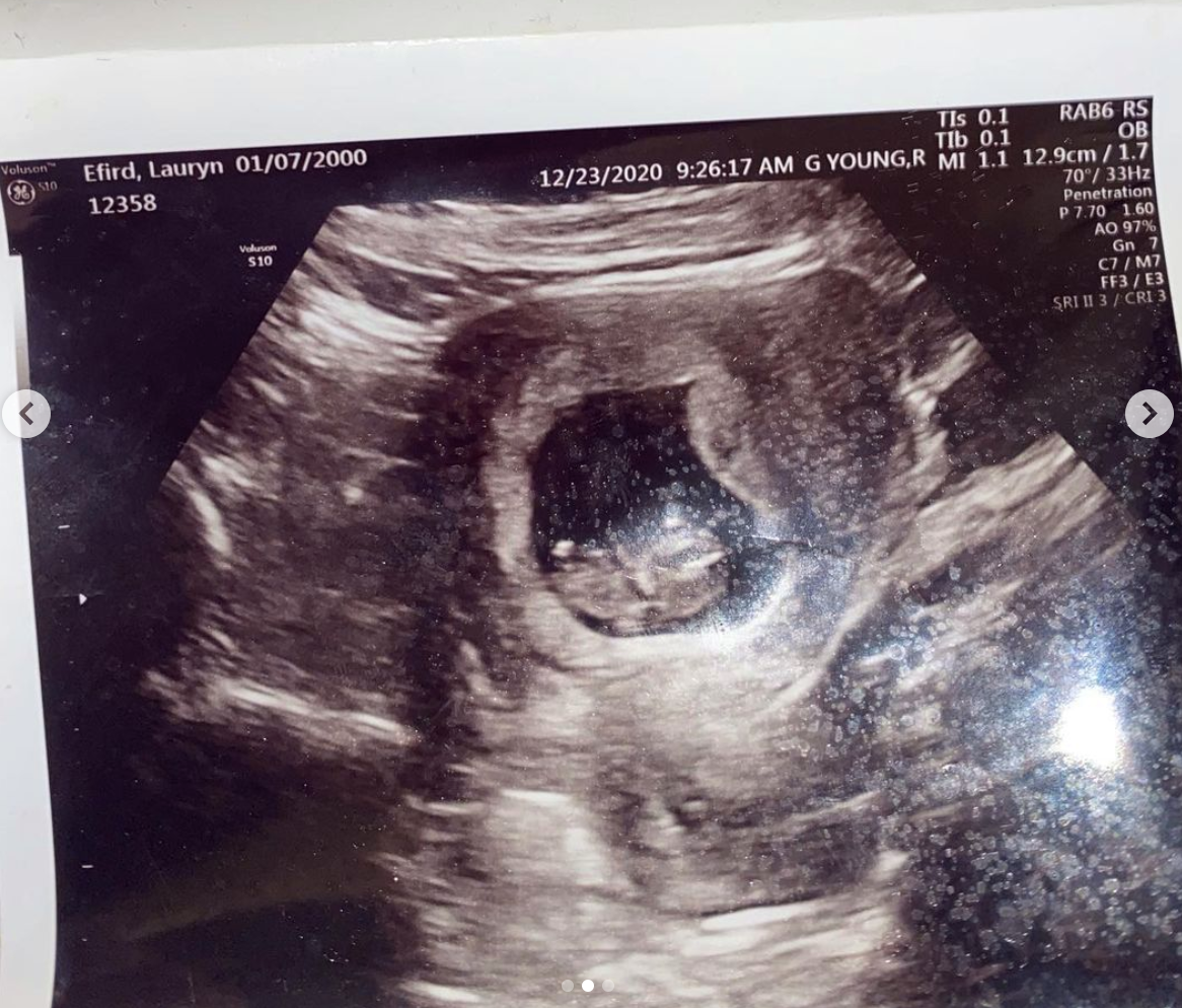 She also shared a sonogram photo dated December 2020