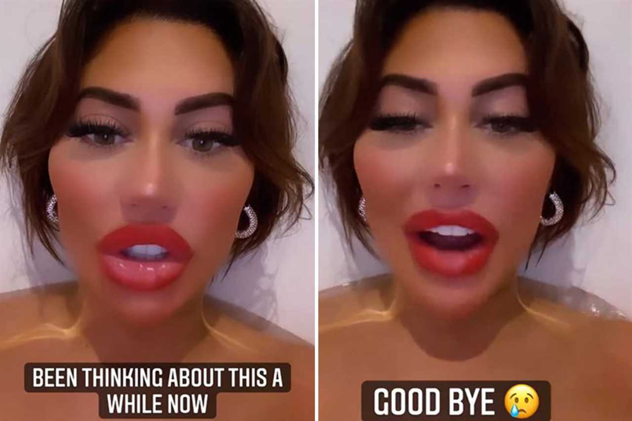 Chloe Ferry sparks concern as she reveals she’s in A&E after getting lip fillers dissolved