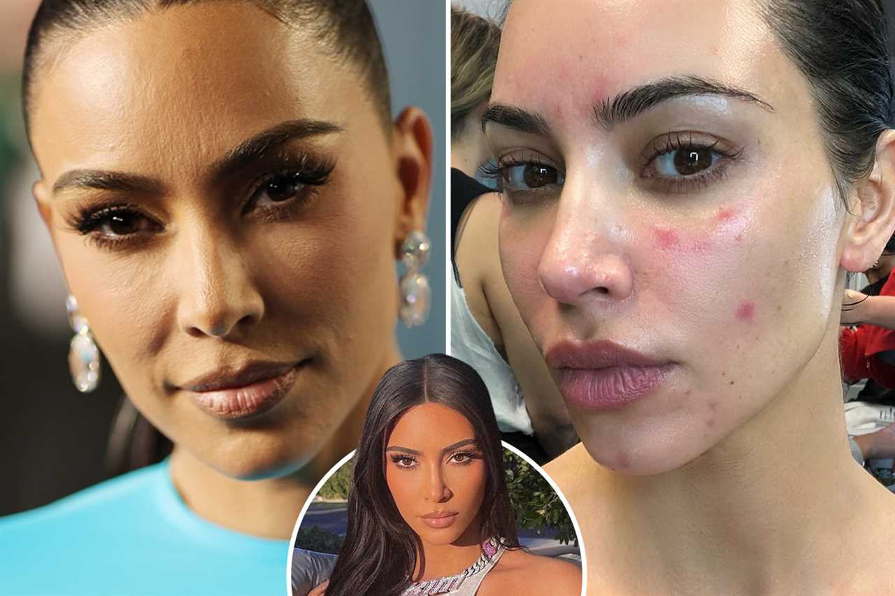 Kardashian fans think Kim looked better with thinner lips as she shows off plumpest pout ever in new interview