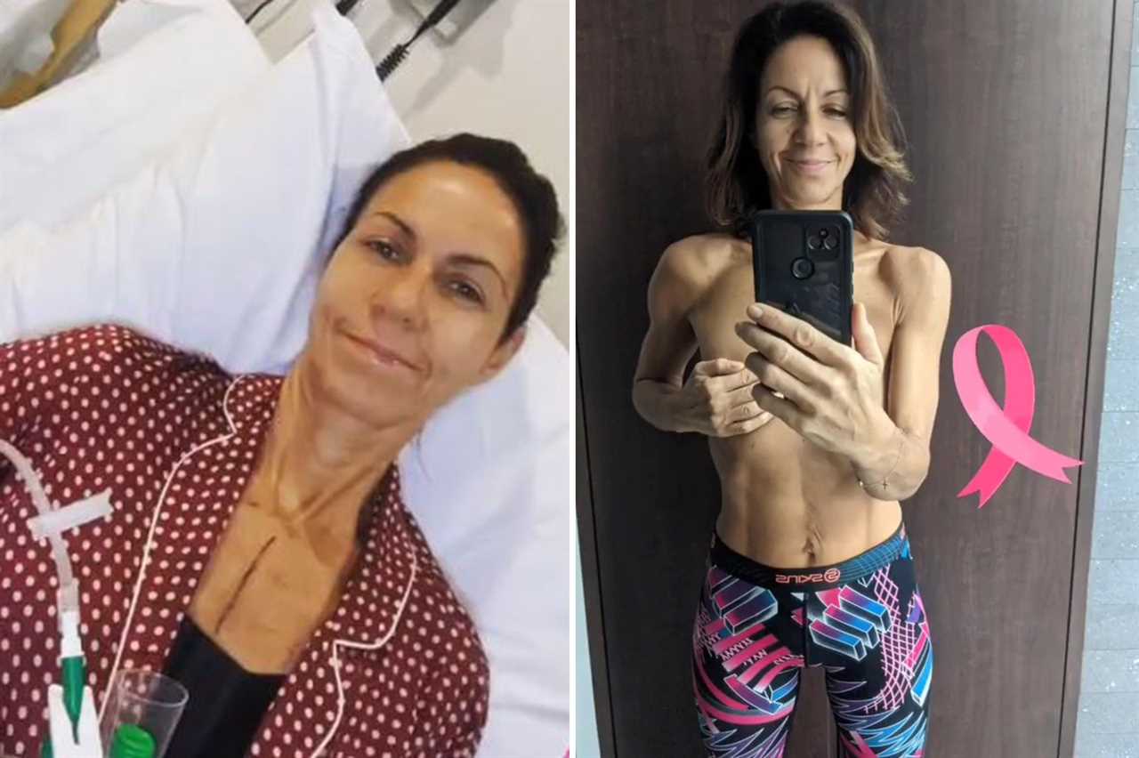 My breast reconstruction after my mastectomy looked like a ‘plasticine boob’, says Countryfile’s Julia Bradbury