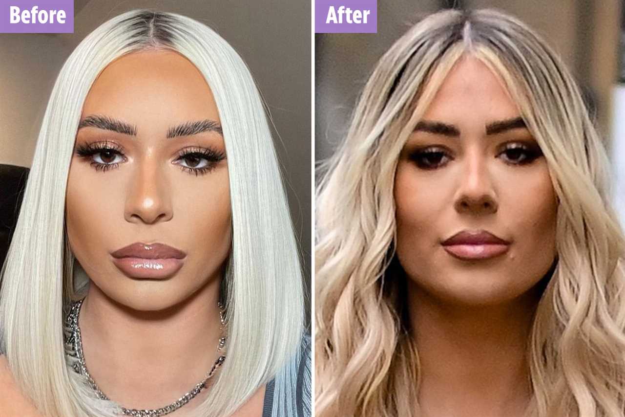 Towie star Demi Sims looks completely different before cosmetic surgery