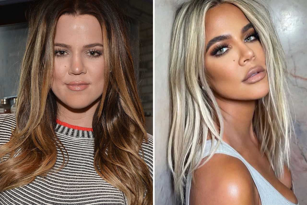Khloe Kardashian sparks more concern after her ‘tiny thigh’ looks thinner than her NECK’ in troubling new photo