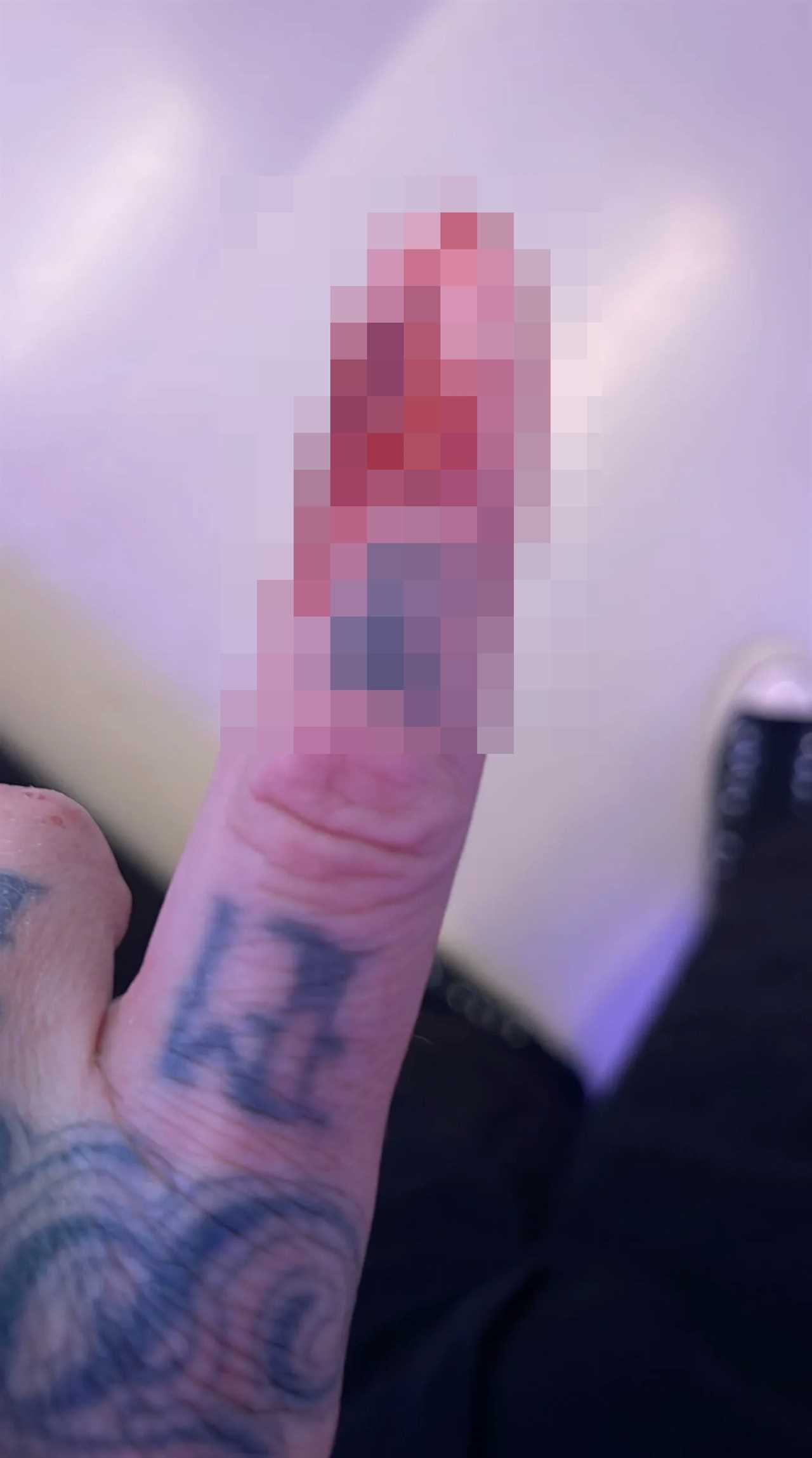 Kourtney Kardashian’s husband Travis Barker shares gruesome photo of his finger covered in blood after hospital stay