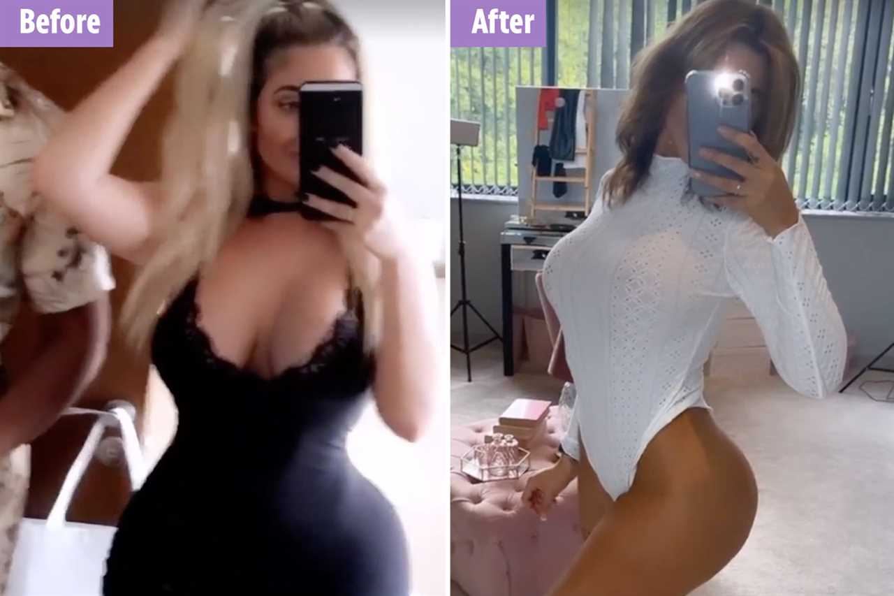 Geordie Shore’s Chloe Ferry shows off botched surgery scars after undergoing ‘fox eye’ op