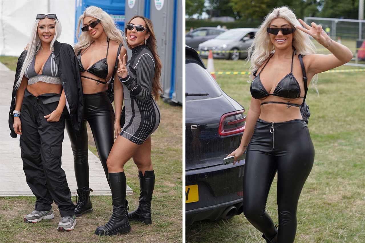 Geordie Shore’s Chloe Ferry shows off botched surgery scars after undergoing ‘fox eye’ op