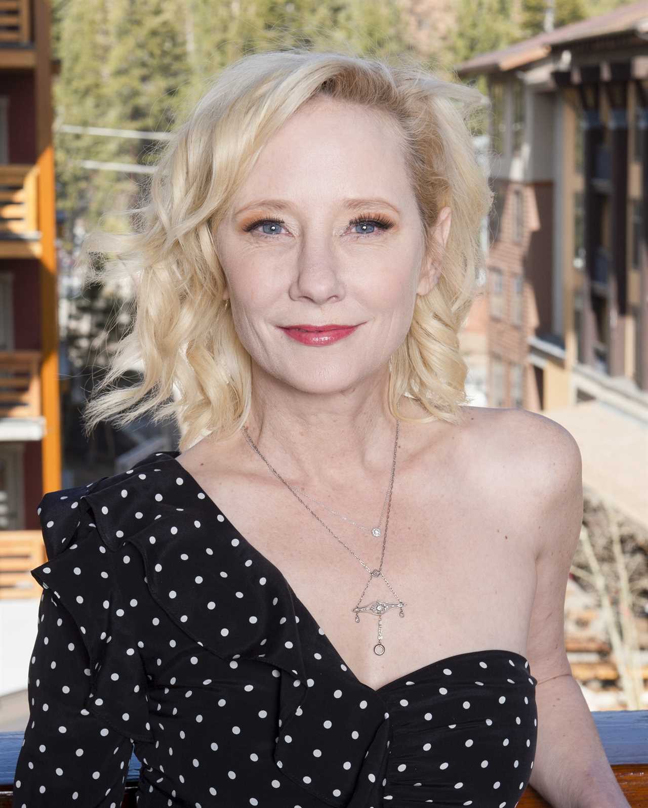 Horror pics of Anne Heche’s fiery car crash revealed after Ellen DeGeneres’ ex is hospitalized with ‘severe burns’