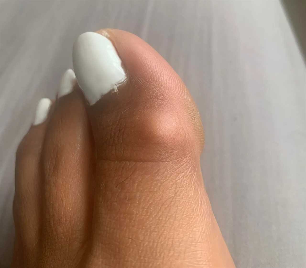 I’m a podiatrist & dreading comeback of 90s classic seen on Meghan Markle & J-Lo – they make your toes turn into claws