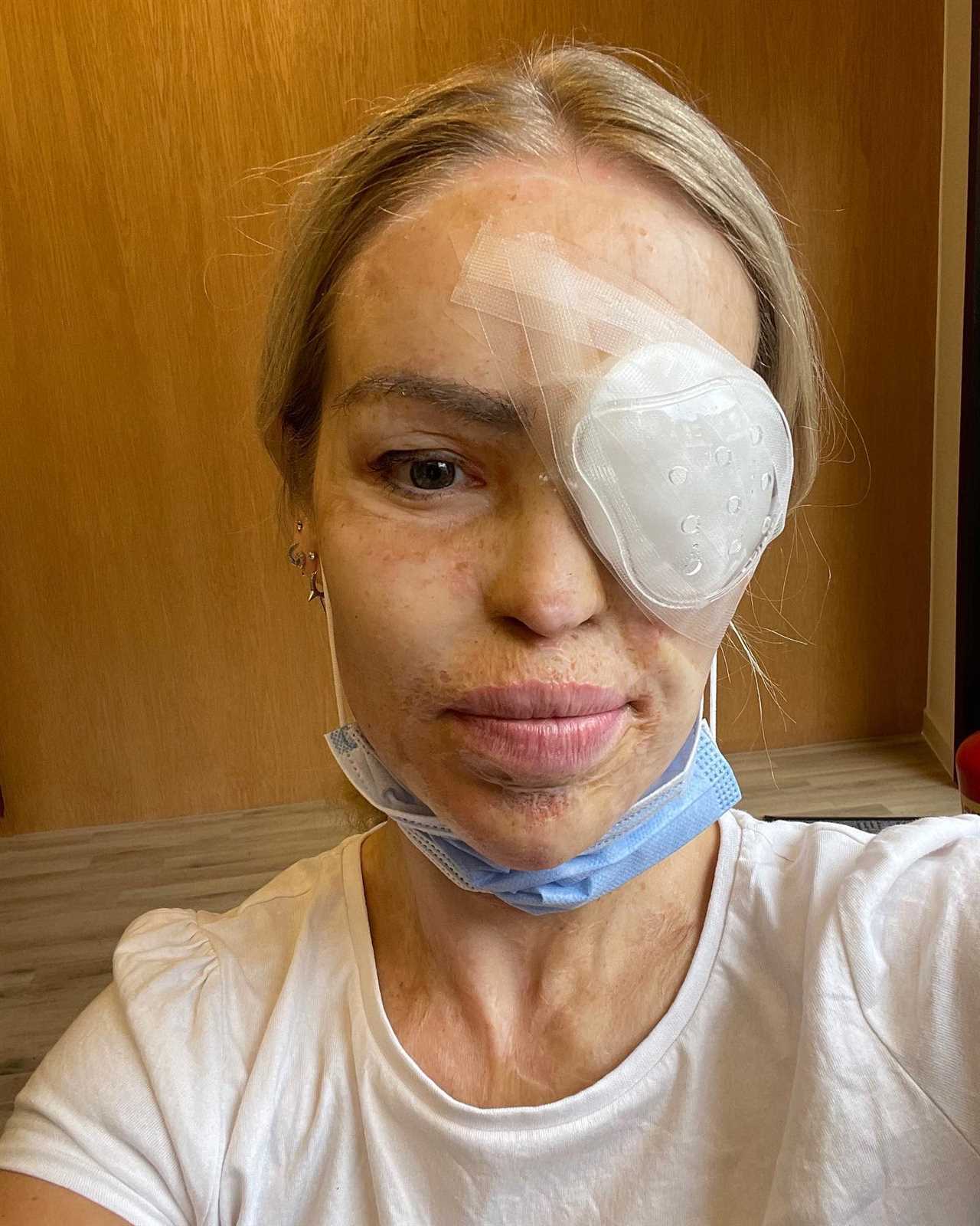 Katie Piper returns to screens days after being rushed to hospital for emergency eye operation