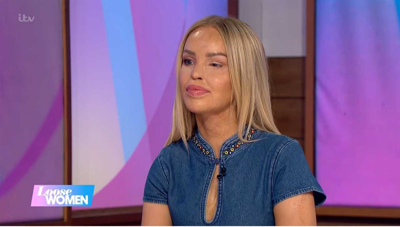 Katie Piper returns to Loose Women after major surgery, revealing tissue from donor was used to fix ‘hole’ in her eye