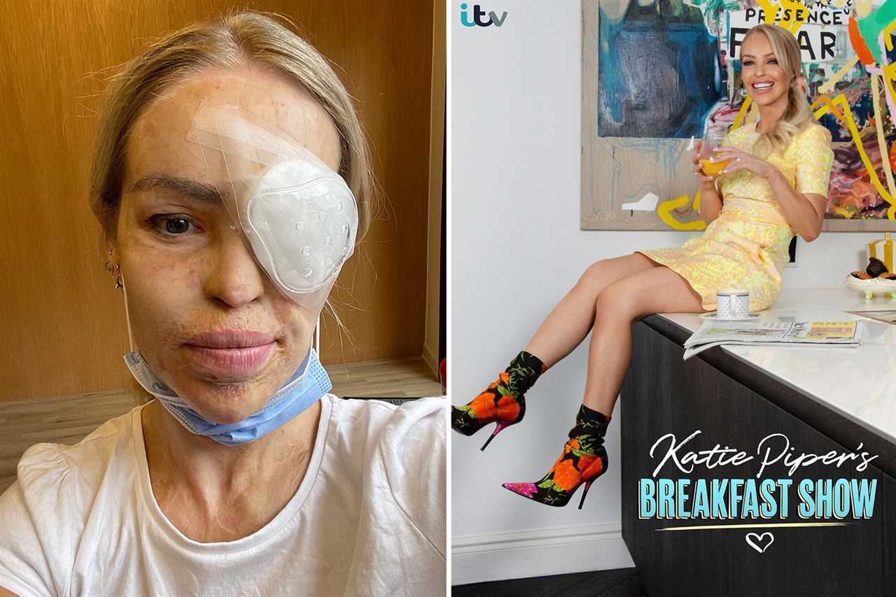 Katie Piper returns to Loose Women after major surgery, revealing tissue from donor was used to fix ‘hole’ in her eye