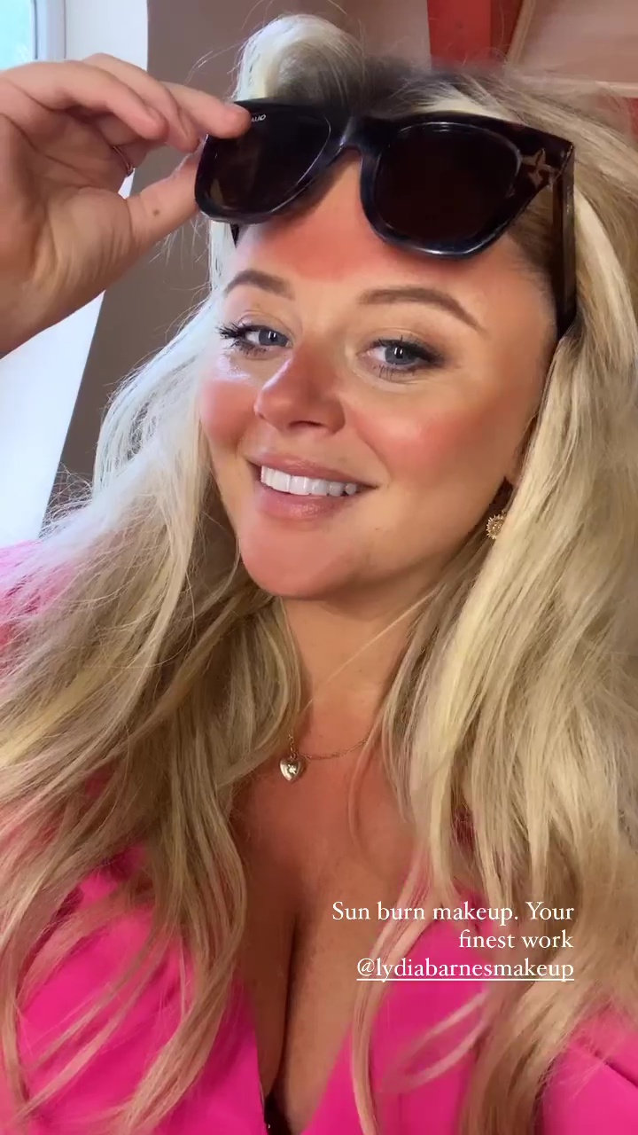 Emily Atack shows off awkward ‘tan line fail’ after holiday to Spain