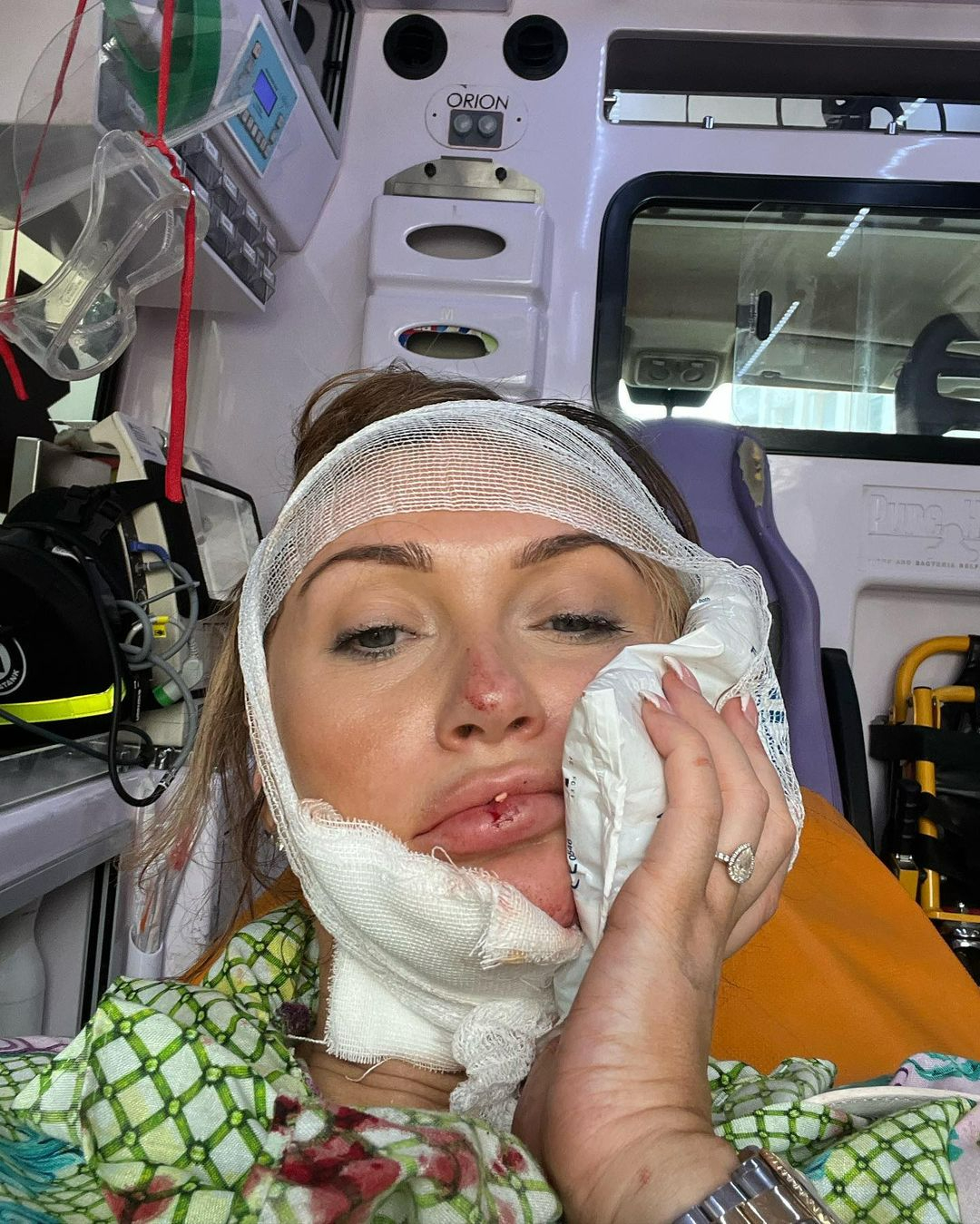 Charlotte Dawson rushed to hospital in Rome after nasty scooter accident