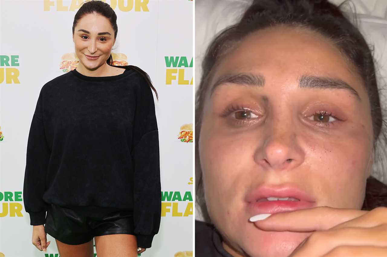 Love Island star Chloe Burrows looks completely different as she removes false eyelashes for bare-faced snap