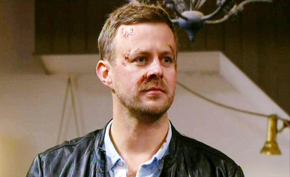 Emmerdale’s Tom Lister in surprise career change 10 years after shock murder of evil villain Carl King