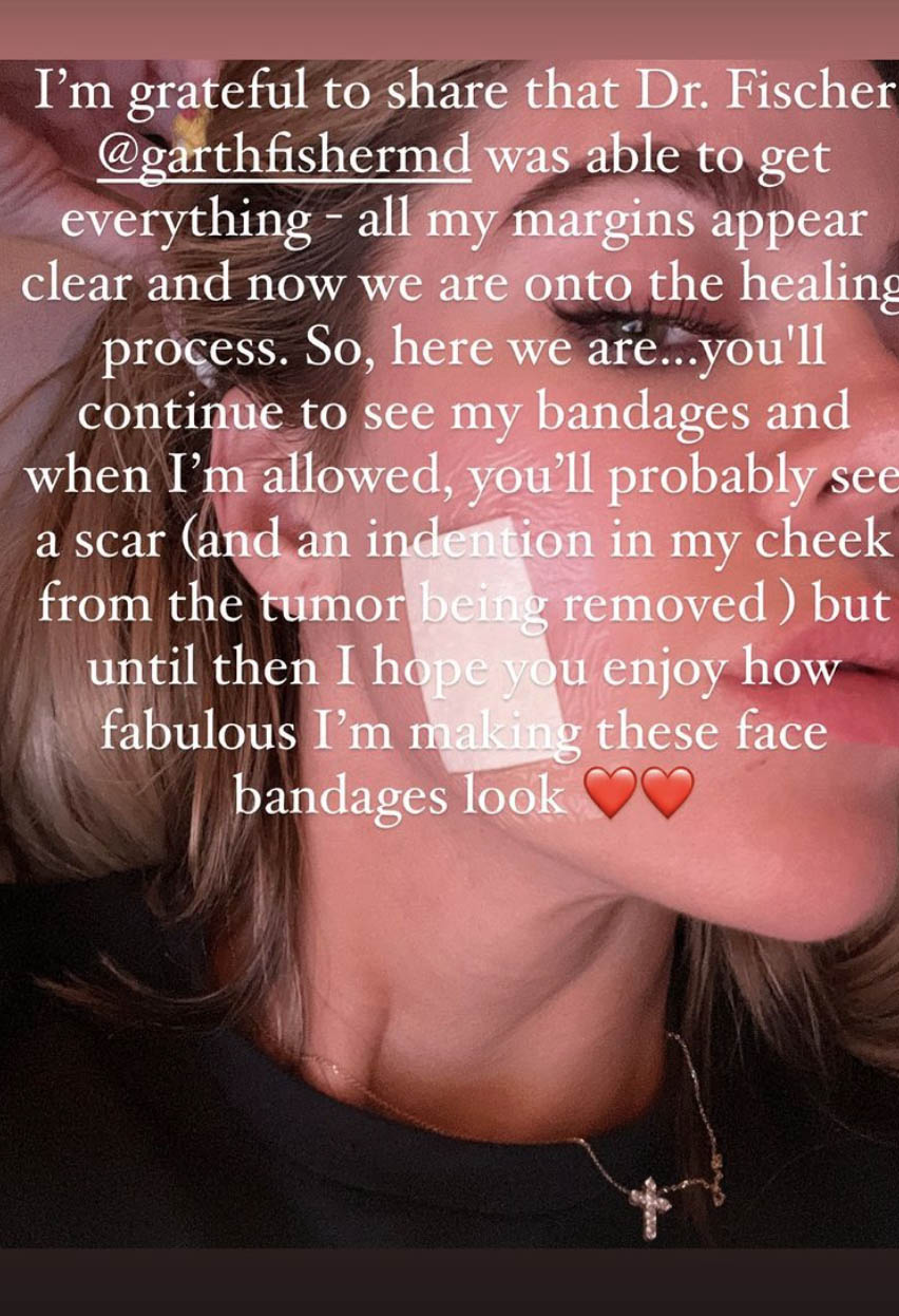 Khloe Kardashian finally reveals the scary reason why she’s wearing a bandage on her face and sends warning to fans