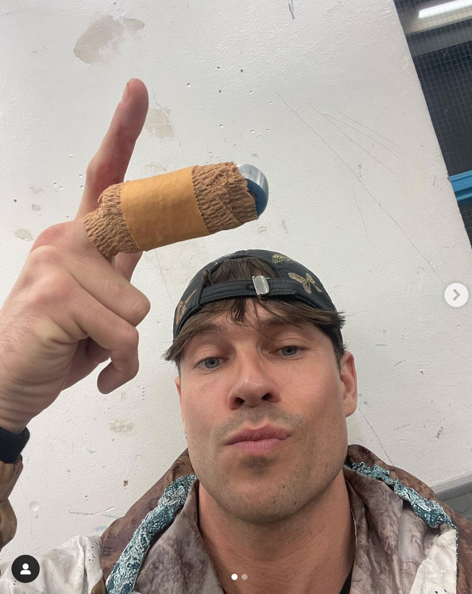 Dancing On Ice’s Joey Essex ‘lucky to have his finger’ after slicing it open in horror smash