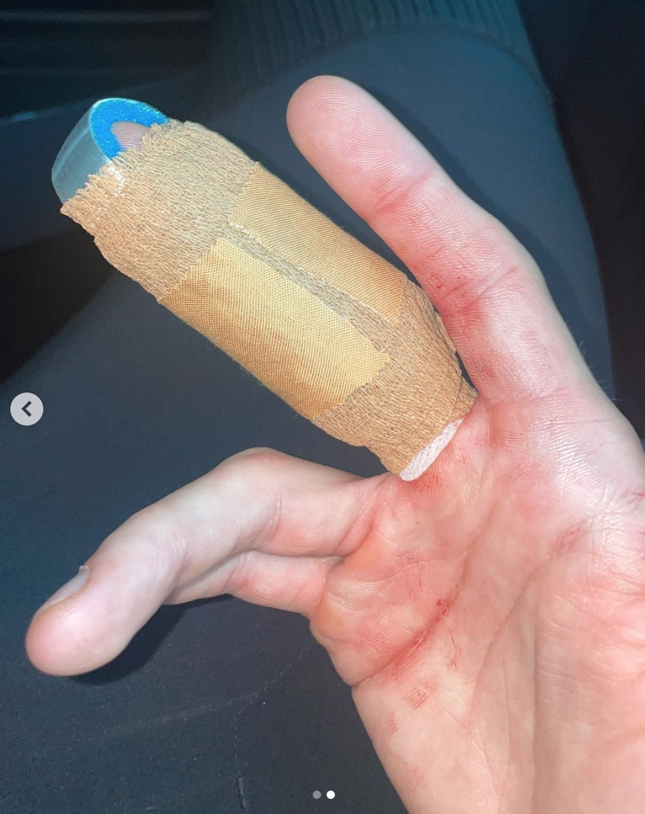 Dancing On Ice’s Joey Essex ‘lucky to have his finger’ after slicing it open in horror smash