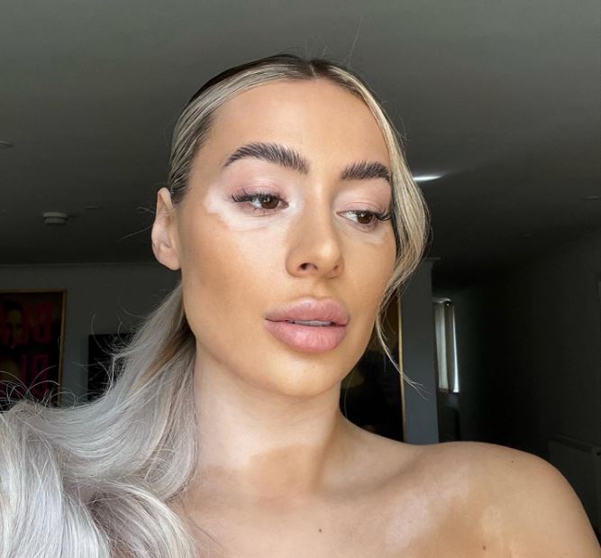 Towie’s Demi Sims strips topless in unfiltered photo as she celebrates her vitiligo