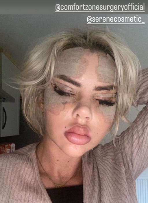 Love Island’s Hannah Elizabeth shows off new face after shock new surgery