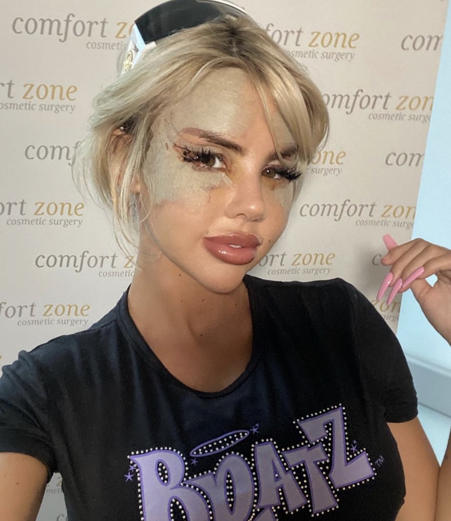 Love Island’s Hannah Elizabeth shows off new face after shock new surgery