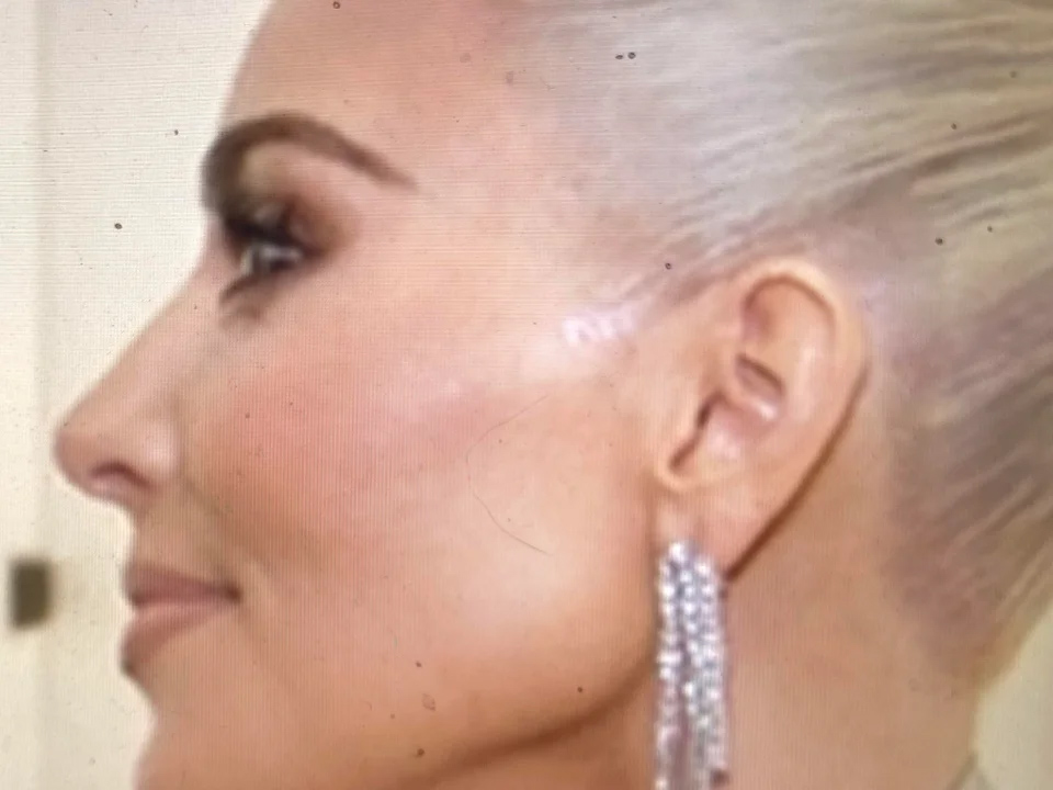 Kardashian fans mock Kim after new unedited photo uncovers star’s hidden ‘face tape’ used to lift cheekbones