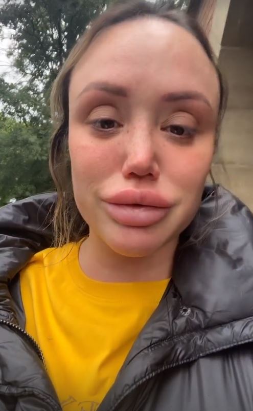 Charlotte Crosby reveals ‘real’ reason why she ditched her ‘humongous’ lip fillers