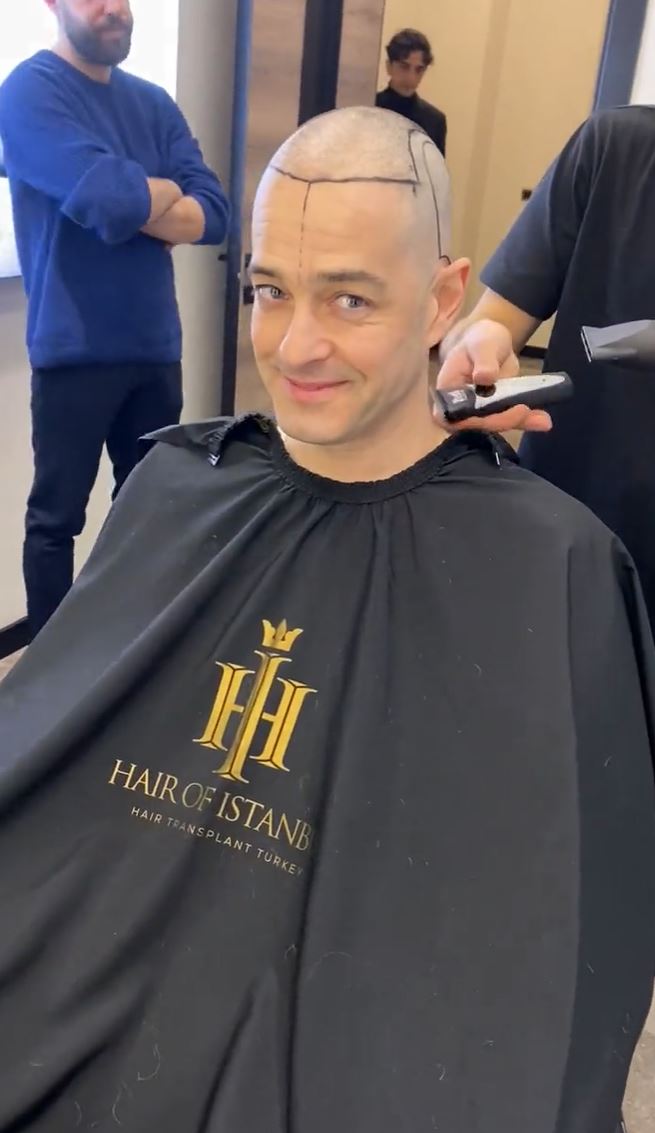 Pop singer looks unrecognisable as he shaves off famous curls before having hair transplant