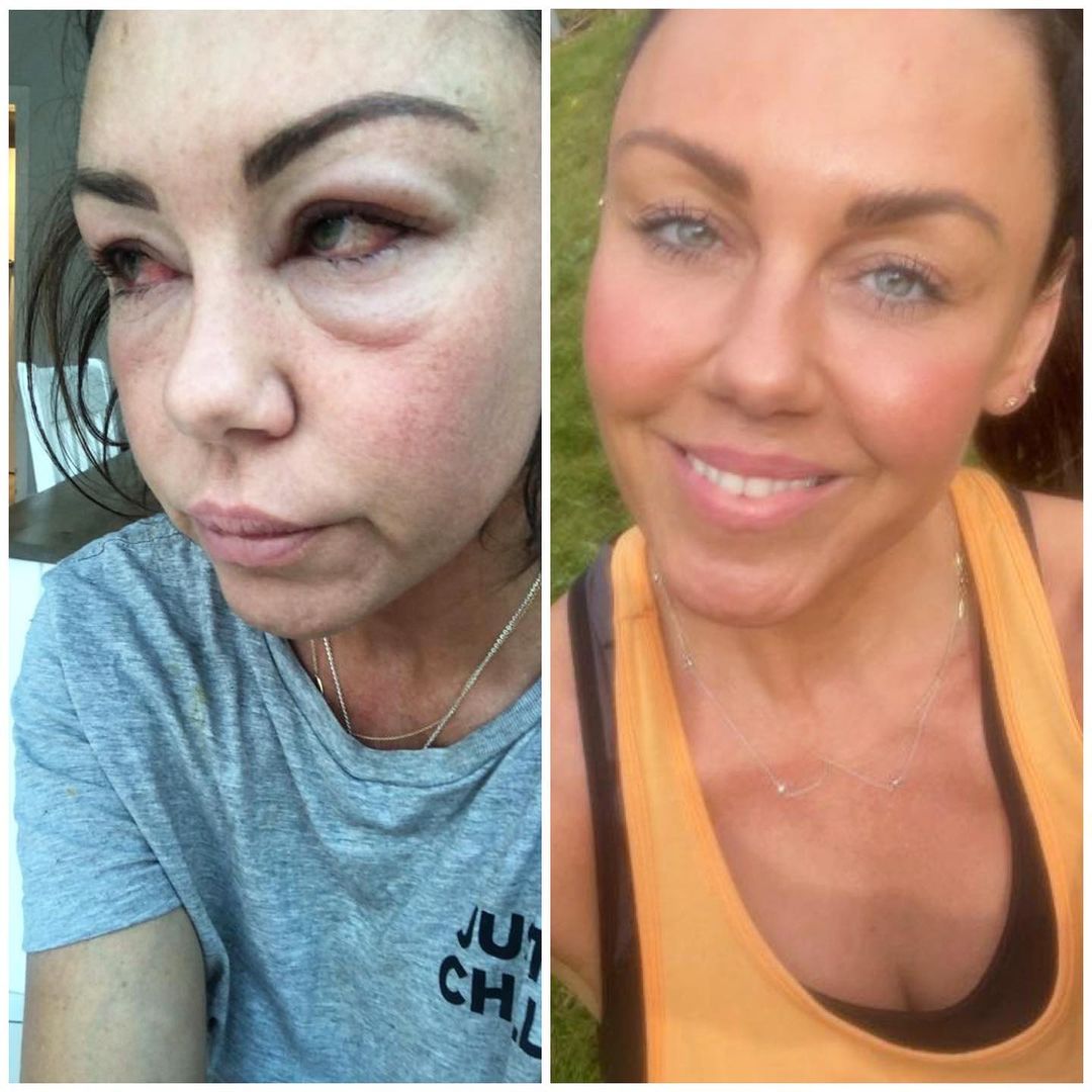 My kids helped me to overcome my addiction, I told them I was allergic to Prosecco, says Michelle Heaton