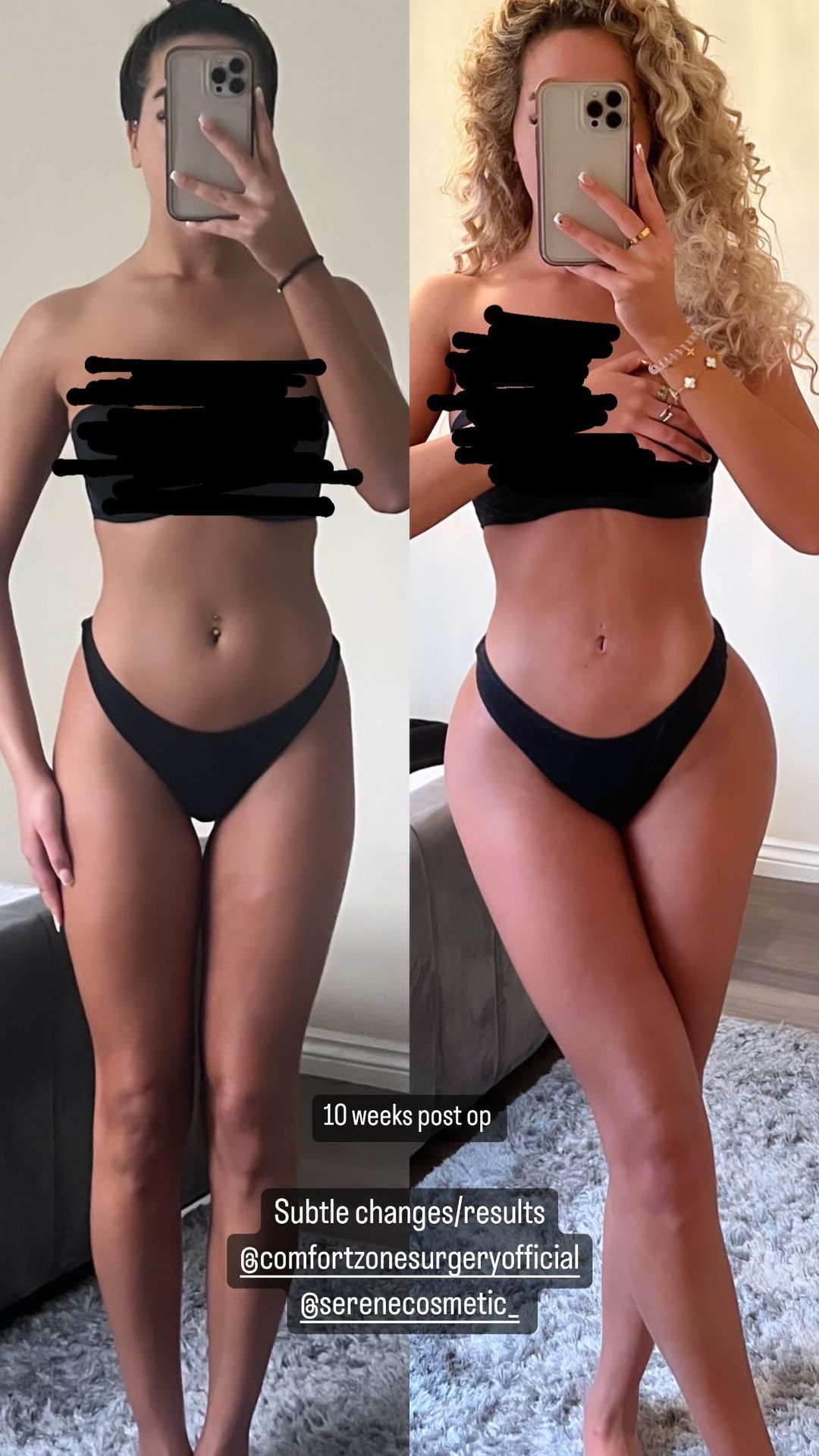 Towie’s Dani Imbert strips to her underwear to show off results of bum surgery in Turkey