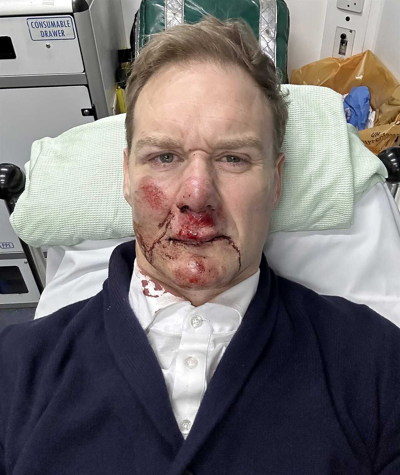 Dan Walker missing from 5News after horror accident as he says he’s ‘lucky to be alive’