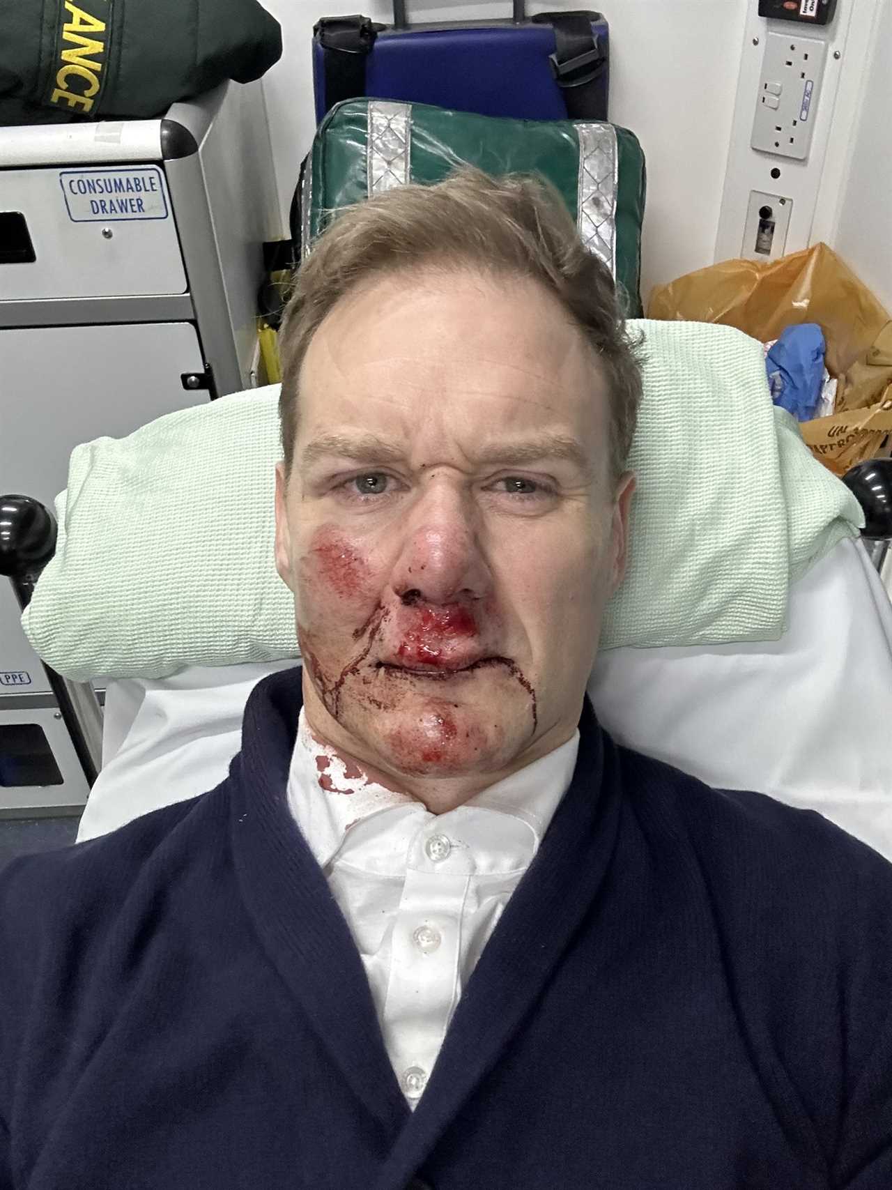Dan Walker reveals he can’t use his left hand after being knocked out when he was hit by car while cycling
