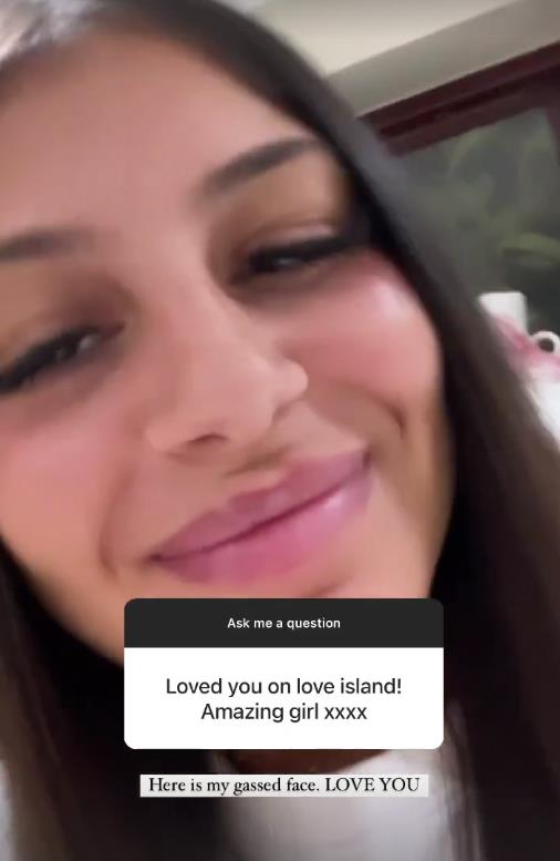 Love Island’s Layla reveals pictures of shocking hair loss as she tells fans she has alopecia