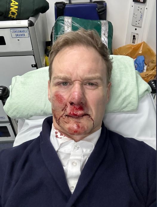 Dan Walker gives fans major health update after terrifying bicycle crash as he reveals blood supply issue