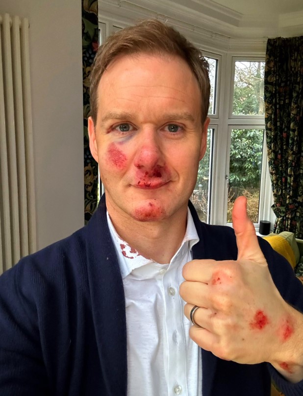 Dan Walker gives fans major health update after terrifying bicycle crash as he reveals blood supply issue