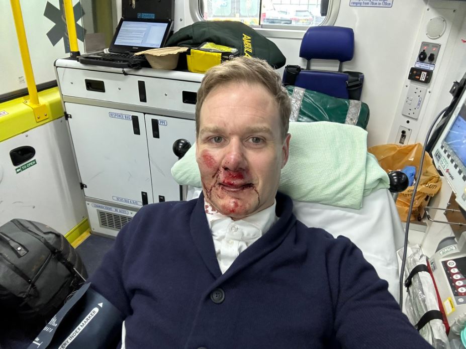 Dan Walker gives fans major health update after terrifying bicycle crash as he reveals blood supply issue