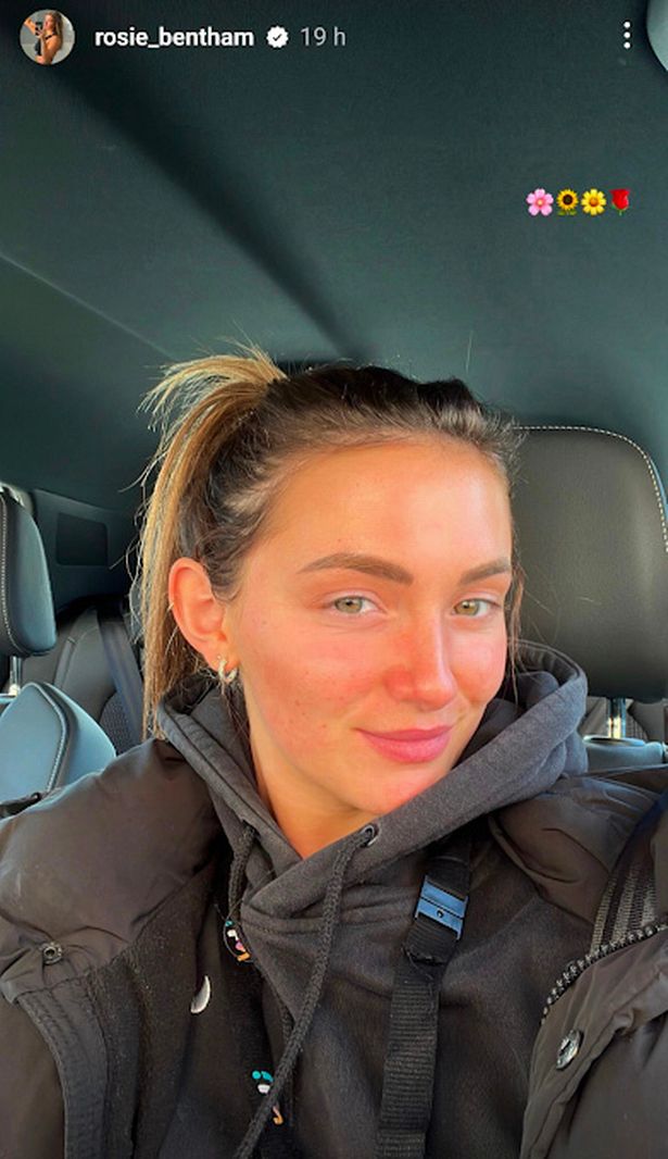 Emmerdale’s Rosie Bentham looks very different make-up free as she shows off natural beauty