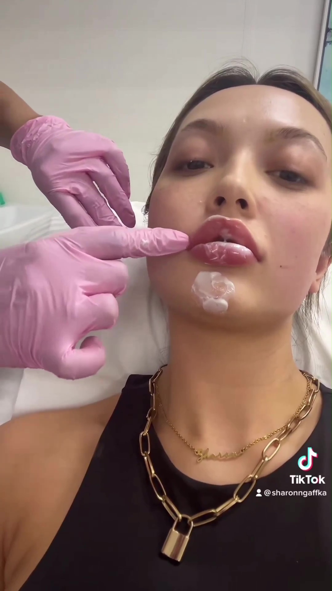 Love Island’s Sharon Gaffka shows off her ‘new lips’ after she gets fillers dissolved