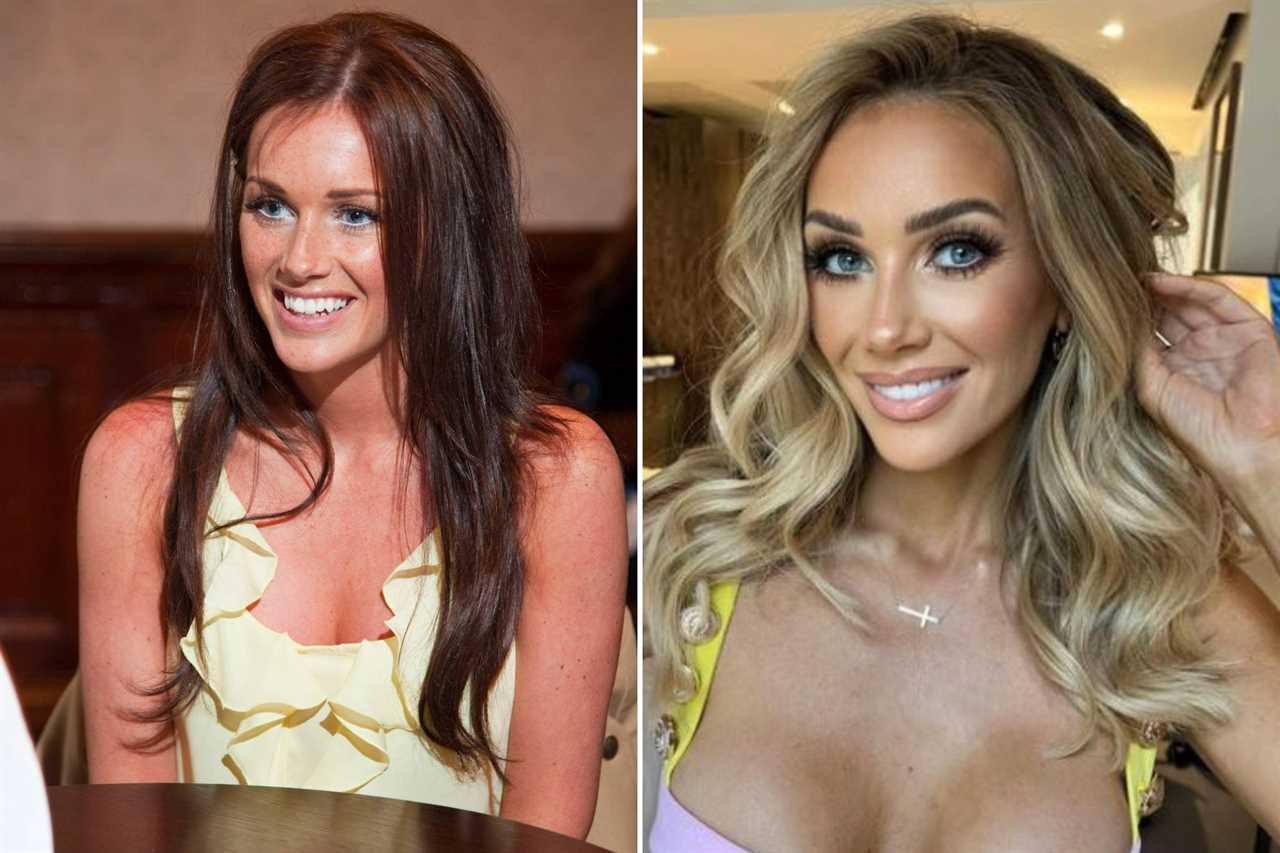 Love Island stars’ changing faces – from star who spent £40k on surgery before show to bombshell’s £4k Turkey teeth