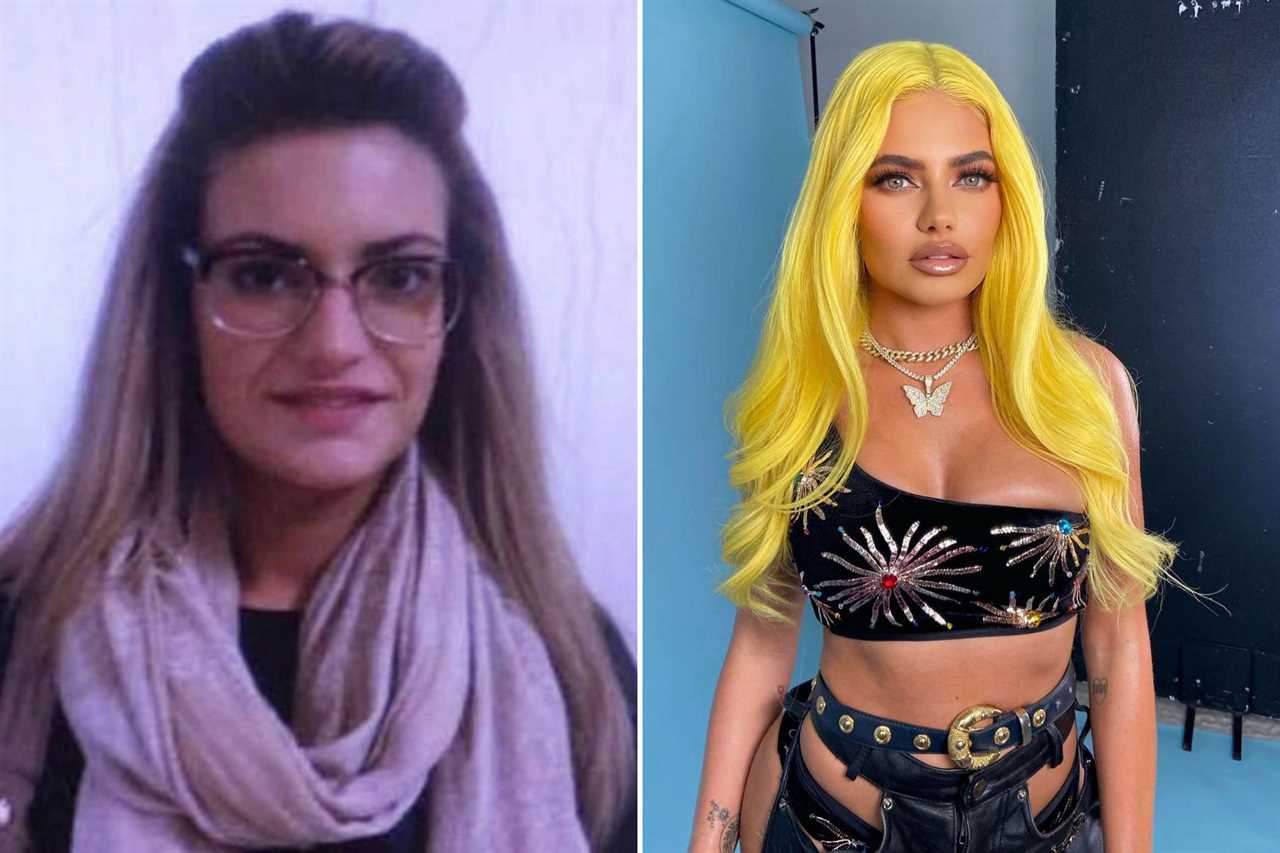 Love Island stars’ changing faces – from star who spent £40k on surgery before show to bombshell’s £4k Turkey teeth