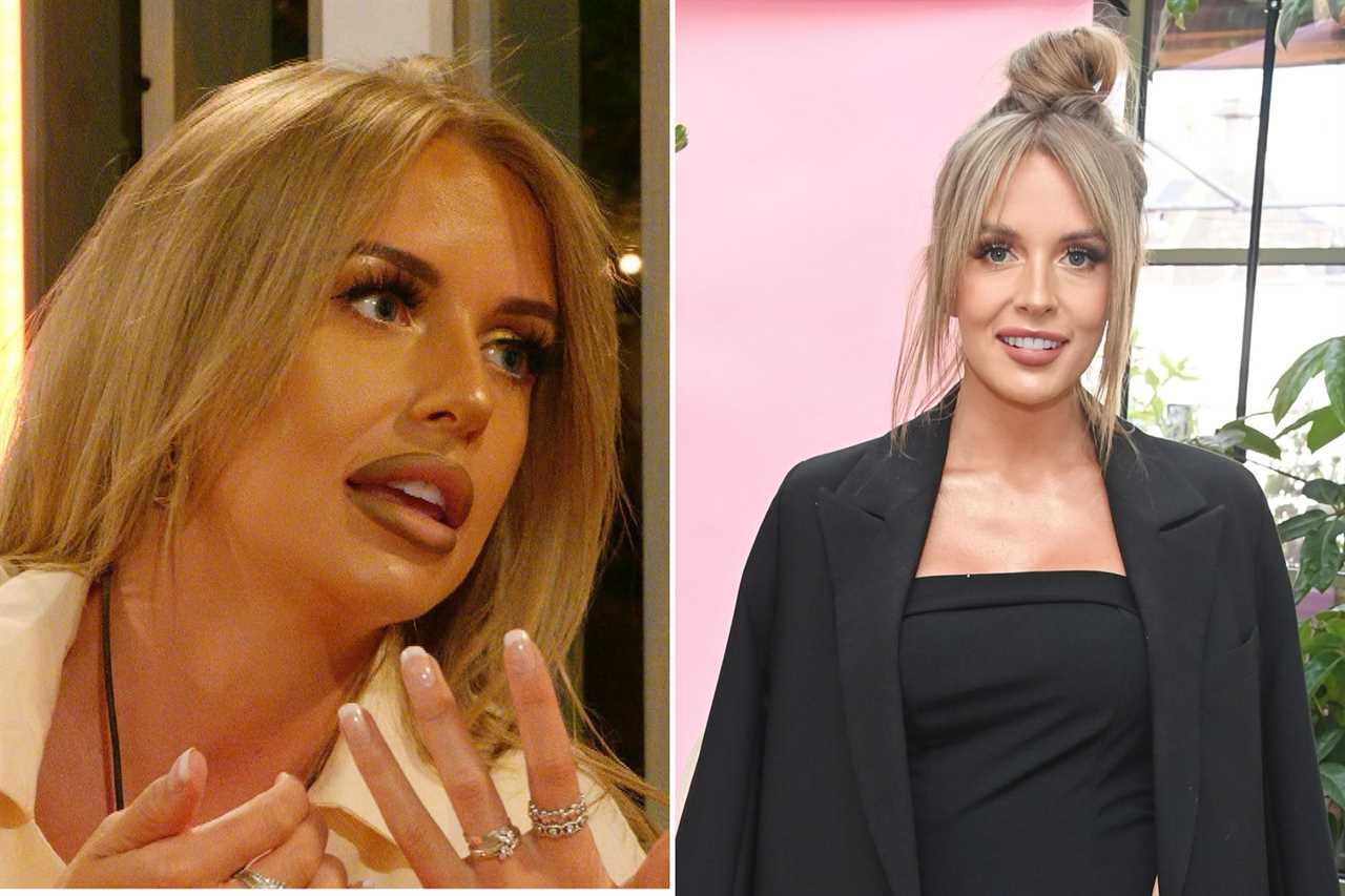 Love Island stars’ changing faces – from star who spent £40k on surgery before show to bombshell’s £4k Turkey teeth