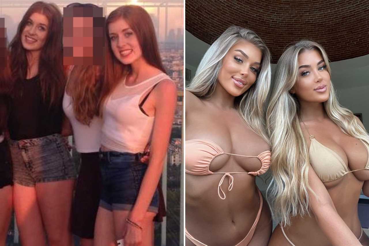 Love Island stars’ changing faces – from star who spent £40k on surgery before show to bombshell’s £4k Turkey teeth