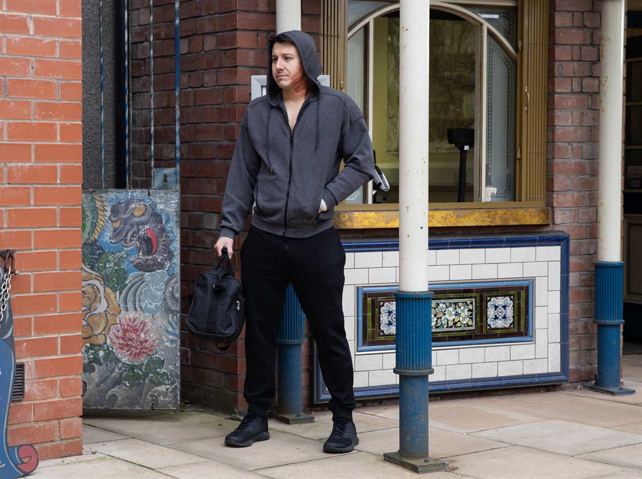 Ryan Connor gets tragic news after acid attack in Coronation Street