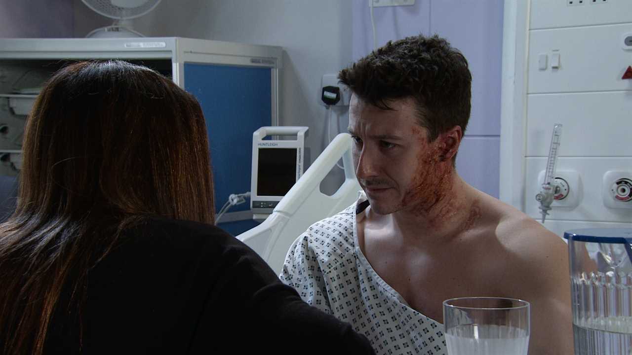 Coronation Street brings in Hollywood experts for Ryan Connor’s grisly acid attack injuries