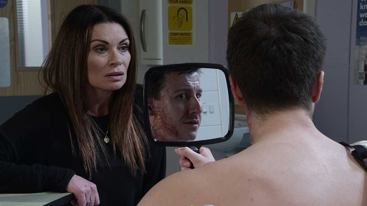 Coronation Street brings in Hollywood experts for Ryan Connor’s grisly acid attack injuries