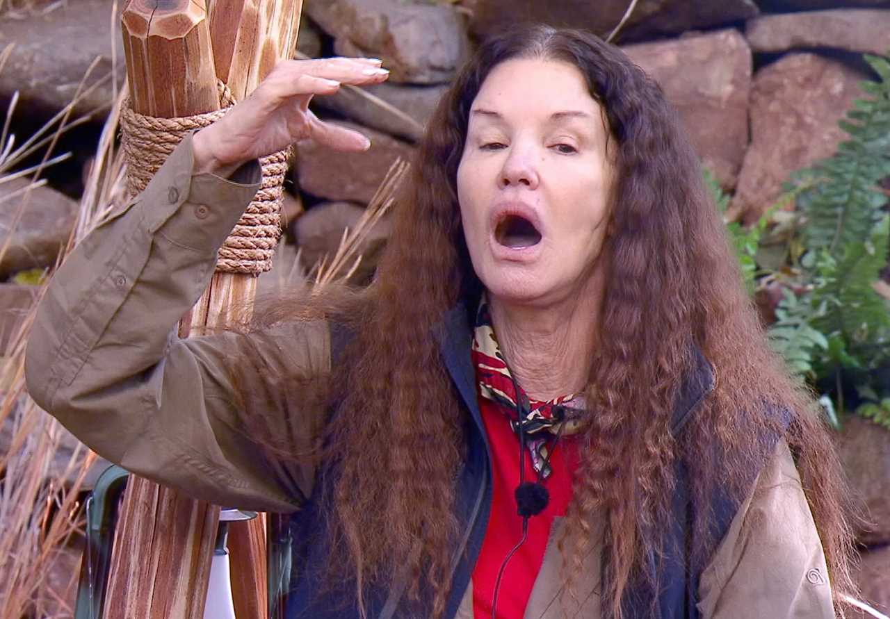 Janice Dickinson breaks silence after quitting I’m A Celeb as dramatic night fall that left her in hospital is revealed