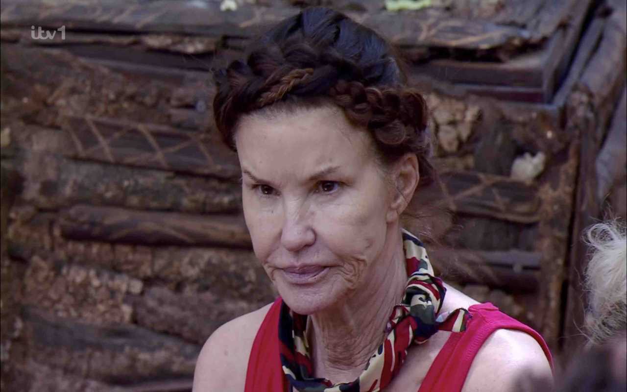 Inside Janice Dickinson’s ‘traumatic’ I’m A Celeb accident that left her ‘scarred & bandaged like a mummy’ as she quits