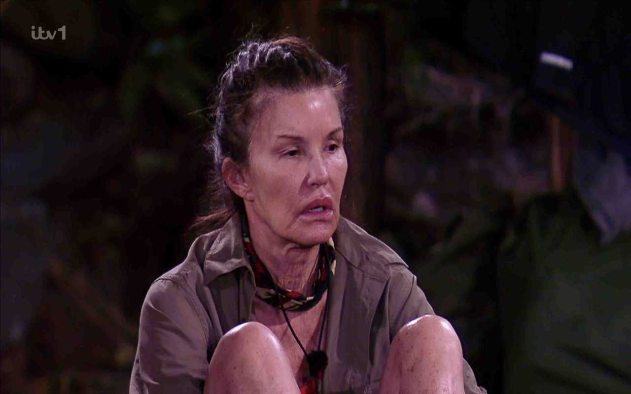 Inside Janice Dickinson’s ‘traumatic’ I’m A Celeb accident that left her ‘scarred & bandaged like a mummy’ as she quits