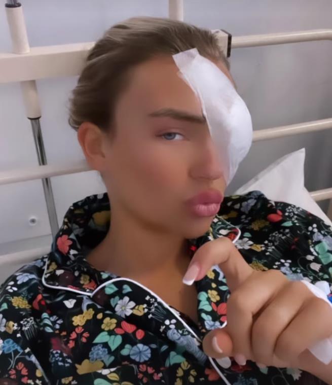 Towie star Ella Rae Wise reveals her EYE is paralysed after doctors operated on mystery lump