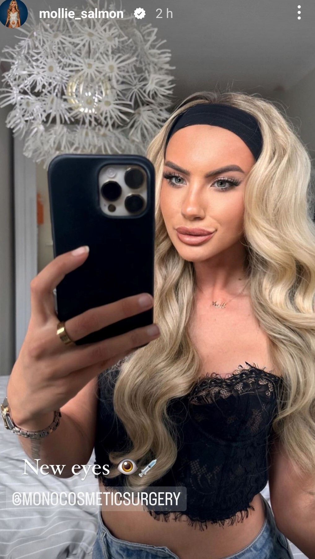 Love Island star unrecognisable as she shows off ‘new face’ after controversial fox eye surgery