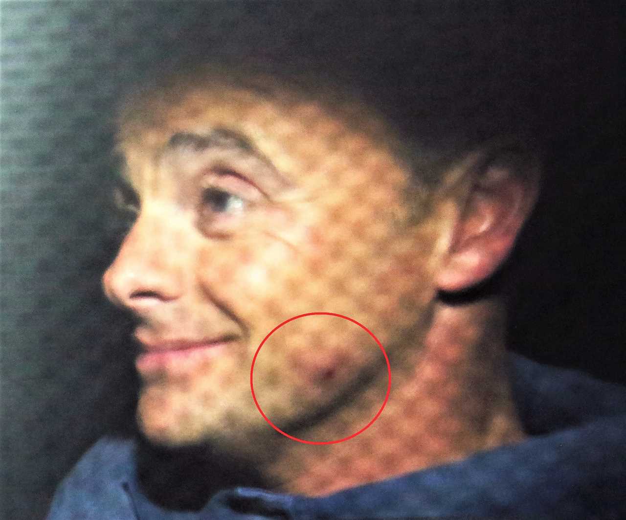 Ant McPartlin seen with a bruised and swollen face after nasty fall on Britain’s Got Talent